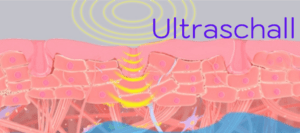 Ultraschall Skin Peeling