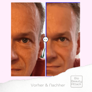 Marc Vorher Nachher(4)