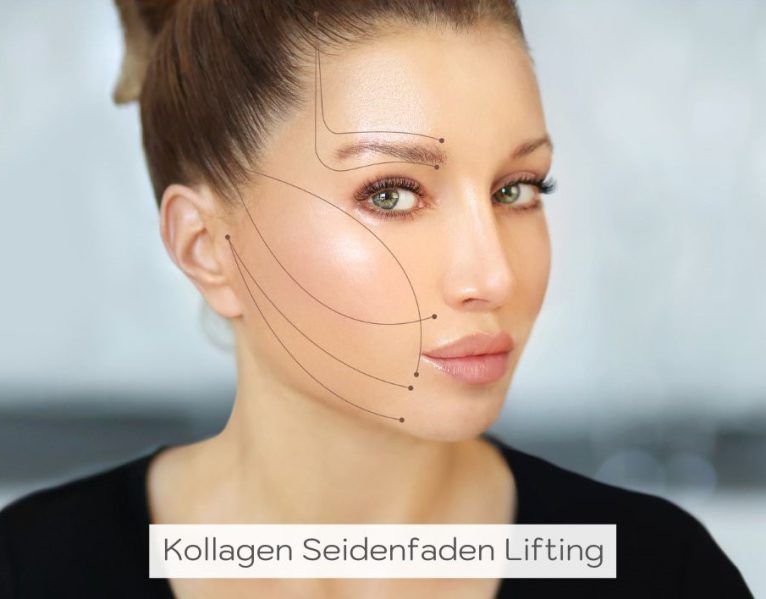 Kollagen Seidenfaden Lifting